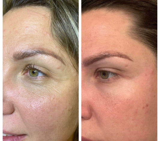 Before and after comparison showing hydrated skin after a Kiwi Spa facial treatment 