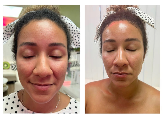 A woman’s radiant, smooth skin after using the Juicy Kiwi Scrub exfoliating treatment at Kiwi Spa.